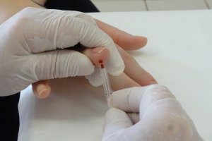 Chapec&oacute; &eacute; uma regi&atilde;o end&ecirc;mica para hepatites 