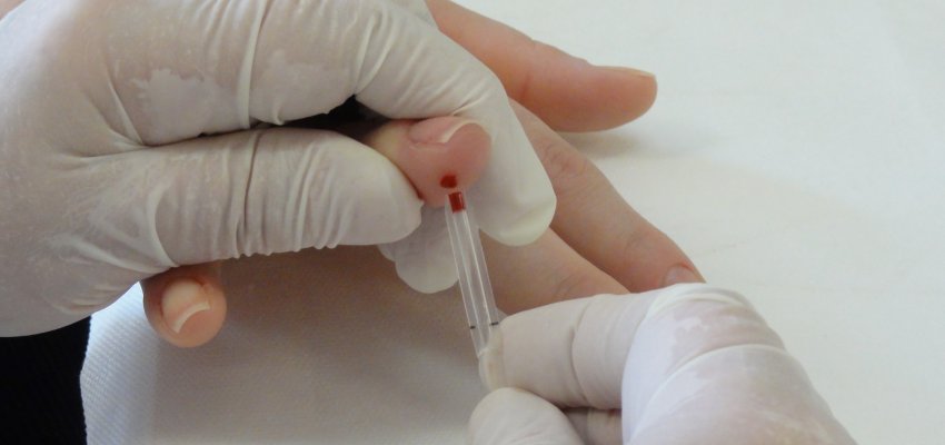 Chapec&oacute; &eacute; uma regi&atilde;o end&ecirc;mica para hepatites 